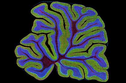 Mouse cerebellum Mouse cerebellum