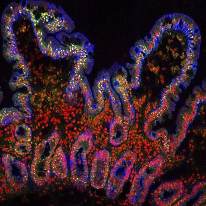Human small intestine Confocal image of the human small intestine