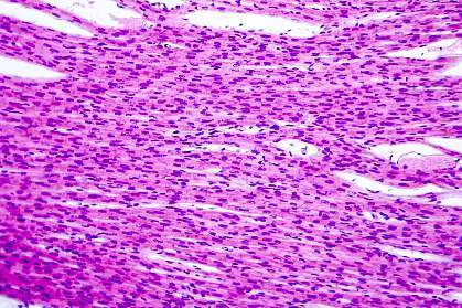 Histological image of heart muscle Histological image of heart muscle