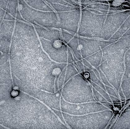 Pf bacteriophages Pf bacteriophages
