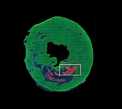 Section of mouse heart Section of mouse heart
