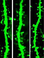 Dendrites with spines Dendrites with spines