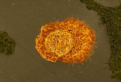 Colorized scanning electron micrograph of a macrophage Colorized scanning electron micrograph of a macrophage