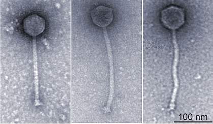 Electron micrographs of three bacteriophages Electron micrographs of three bacteriophages