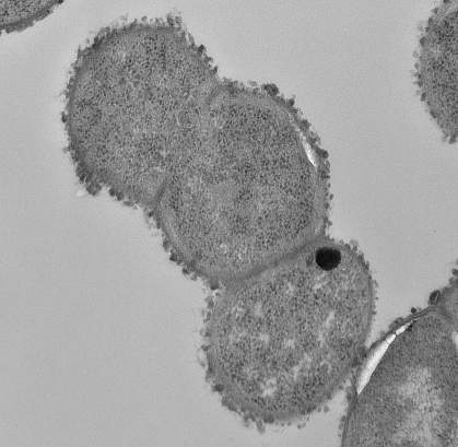Electron micrograph of Ruminococcus gnavus Electron micrograph of Ruminococcus gnavus