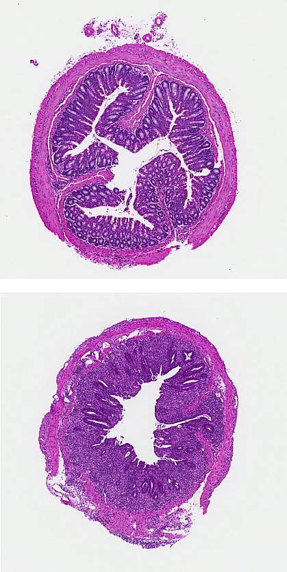 Sections of mouse colon tissue Sections of mouse colon tissue