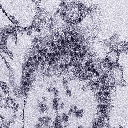 Transmission electron microscope image of EV-D68 virions Electron microscope image revealing numerous, spheroid shaped EV-D68 virions