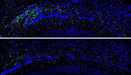 Astrocytes in mouse corpus callosum Astrocytes in mouse corpus callosum