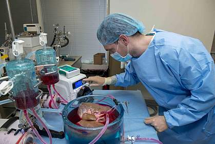 Machine perfusion system with human liver Machine perfusion system with human liver
