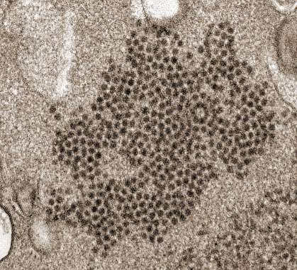 Enterovirus EV-D68 virions Electron microscope image of EV-D68 virions