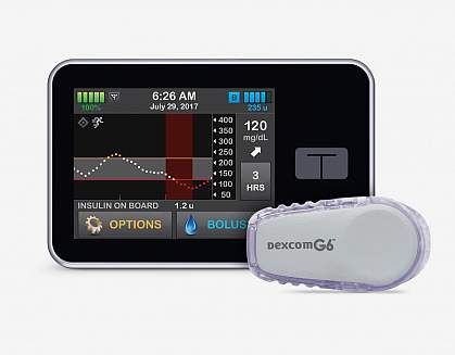 Control-IQ artificial pancreas system Control-IQ artificial pancreas system