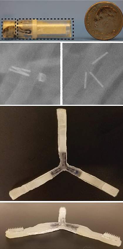 Luminal unfolding microneedle injector Luminal unfolding microneedle injector