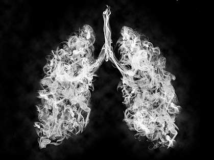 Illustration of toxic vapor in a lung Illustration of toxic vapor in a lung
