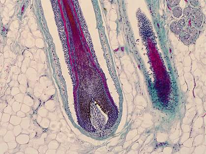 Microscope image of a hair follicle in human skin Microscope image of a hair follicle in human skin