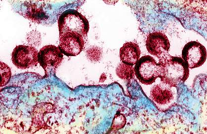 HIV virions budding from an infected cell. HIV virions budding from an infected cell.