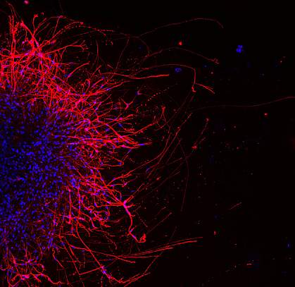 Neurons growing neurites Neurons growing neurites