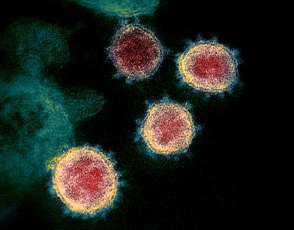 SARS-CoV-2 SARS-CoV-2
