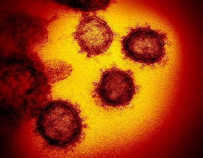 Novel Coronavirus SARS-CoV-2 Novel Coronavirus SARS-CoV-2