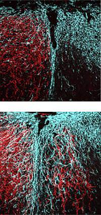 Axon regeneration Axon regeneration