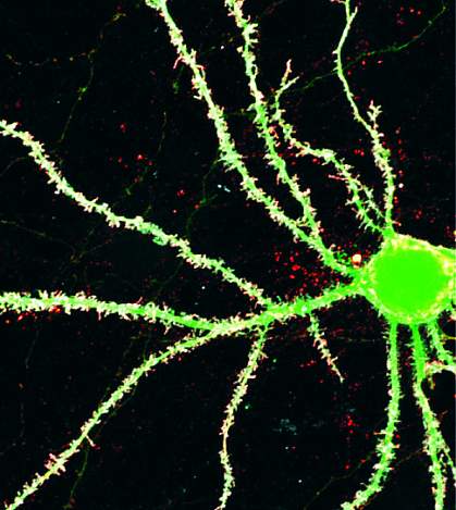 Image of a brain cell Image of a brain cell