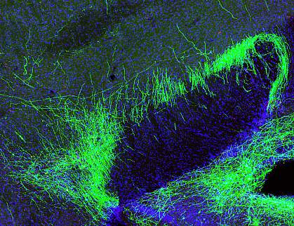 Pain suppression neurons in mouse brain. Pain suppression neurons in mouse brain.