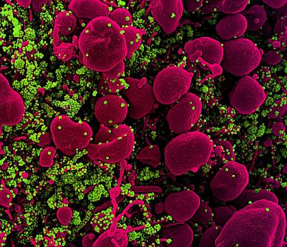 SARS-COV-2 virus particles SARS-COV-2 virus particles