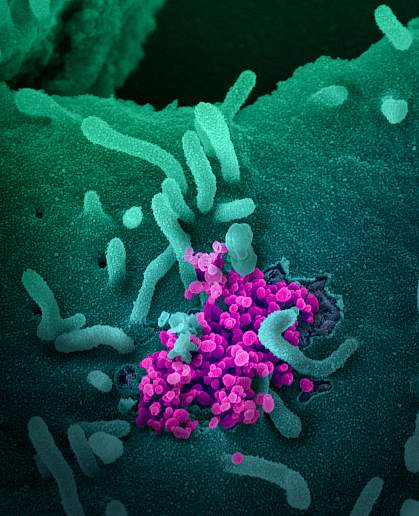 Novel Coronavirus SARS-CoV-2 Novel Coronavirus SARS-CoV-2