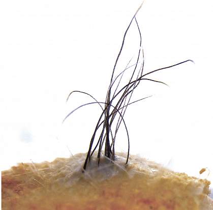 Skin with hairs Skin with hairs