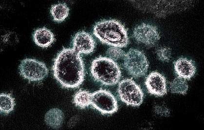 Transmission electron microscope image of novel coronavirus SARS-CoV-2 Transmission electron microscope image of novel coronavirus SARS-CoV-2