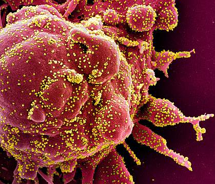 Novel Coronavirus SARS-CoV-2 Novel Coronavirus SARS-CoV-2
