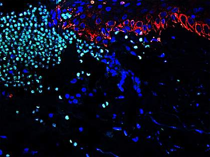 Neutrophils in acute human skin wound Neutrophils in acute human skin wound