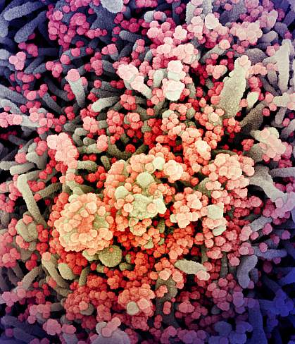 SARS-CoV-2 virus particles SARS-CoV-2 virus particles