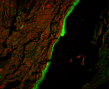 Immunofluorescent image of mucus barrier around red mass Immunofluorescent image of mucus barrier around red mass