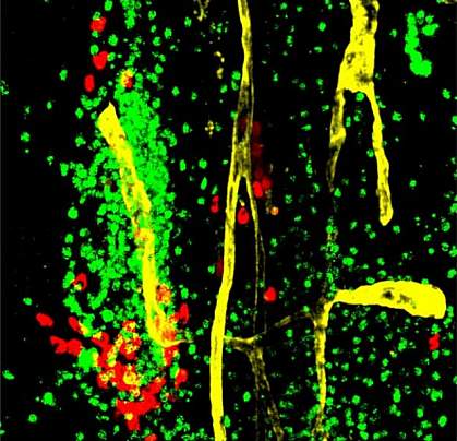 Immune cells in dura mater Immune cells in dura mater
