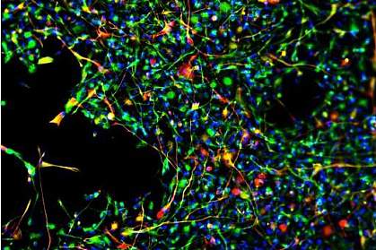 Fluorescent microscope image of neural stem cells maturing Fluorescent microscope image of neural stem cells maturing