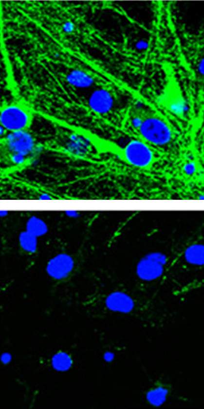 Immunofluorescence images of tau in neurons 