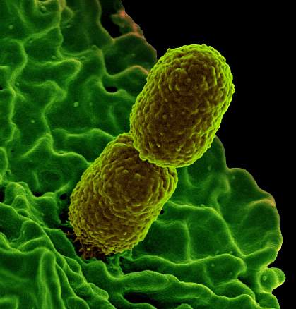 Klebsiella pneumoniae on surface of human neutrophil Klebsiella pneumoniae on surface of human neutrophil