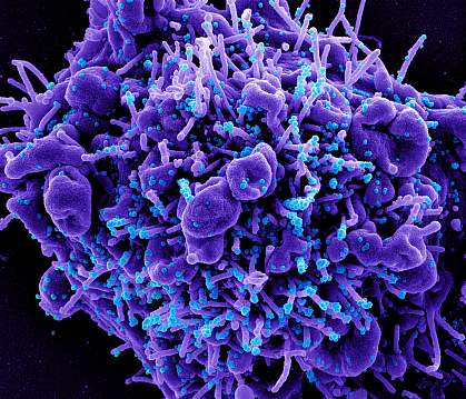 Novel Coronavirus SARS-CoV-2 Novel Coronavirus SARS-CoV-2