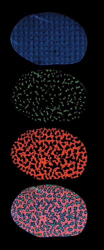 Liver lobe cross-section Hepatocytes in a cross-section of a liver lobe