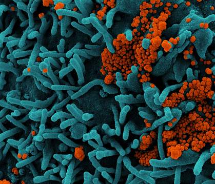 Novel Coronavirus SARS-CoV-2 Novel Coronavirus SARS-CoV-2