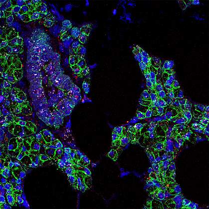Fluorescent microscopy image of RNA for SARS-CoV-2 and ACE2 receptor in human salivary gland cells Fluorescent microscopy image of RNA for SARS-CoV-2 and ACE2 receptor in human salivary gland cells