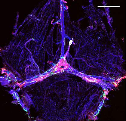 Amyloid beta deposits in mouse meningeal lymphatic tissue Amyloid beta deposits in mouse meningeal lymphatic tissue