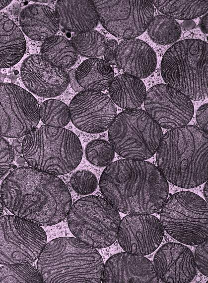 Round mitochondria of various sizes in a brown fat cell