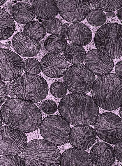 Round mitochondria of various sizes in a brown fat cell Round mitochondria of various sizes in a brown fat cell