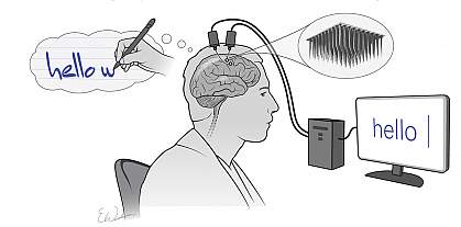 Cartoon of man thinking about writing a sentence while electrodes implanted into his brain send a signal that appears as words on a computer screen Cartoon of man thinking about writing a sentence while electrodes implanted into his brain send a signal that appears as words on a computer screen