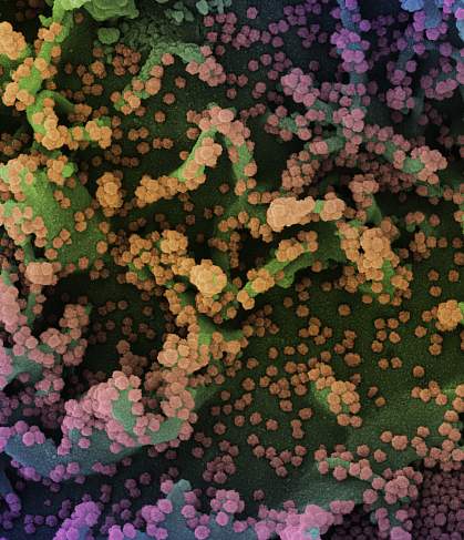 Novel Coronavirus SARS-CoV-2 Novel Coronavirus SARS-CoV-2