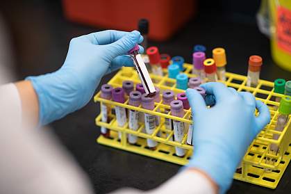 Blood vials being placed in a rack