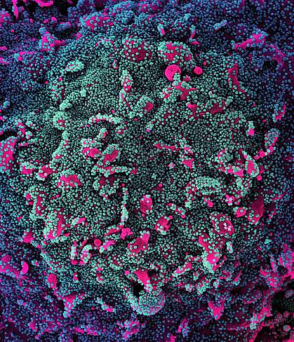 Novel coronavirus SARS-CoV-2 Novel coronavirus SARS-CoV-2