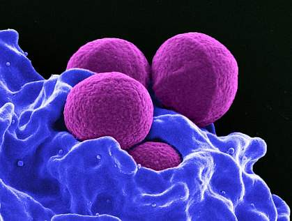 MRSA bacteria MRSA bacteria
