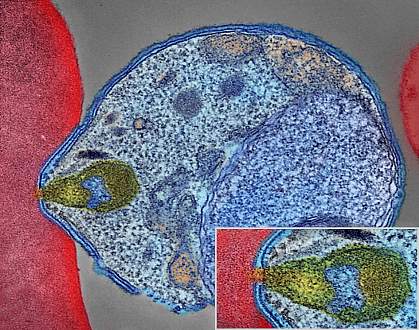 Malaria parasite attaching to human red blood cell